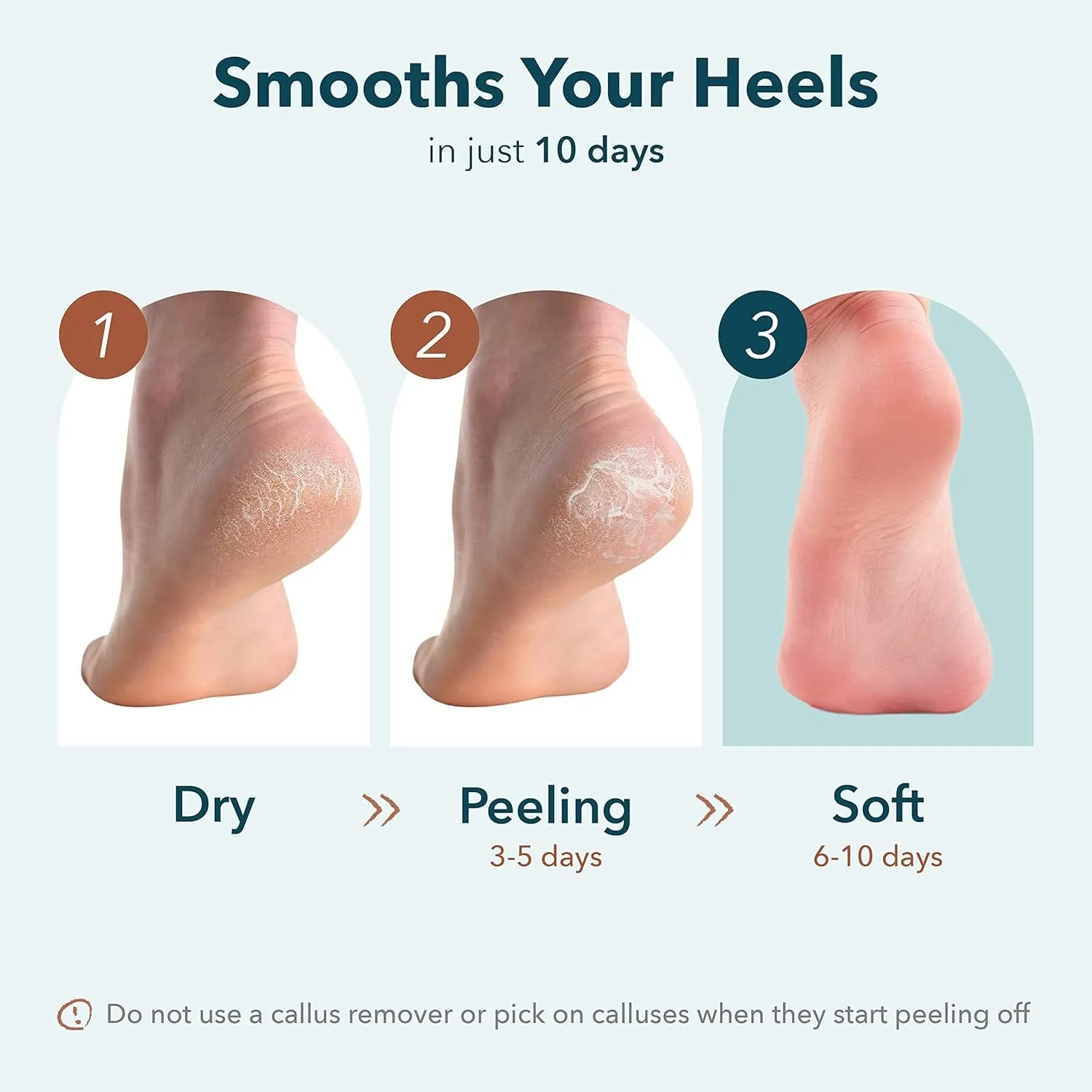 Exfoliating Heel Mask (1 Pair) – Heel Peeling Masks Gently Remove Calluses from Your Heel